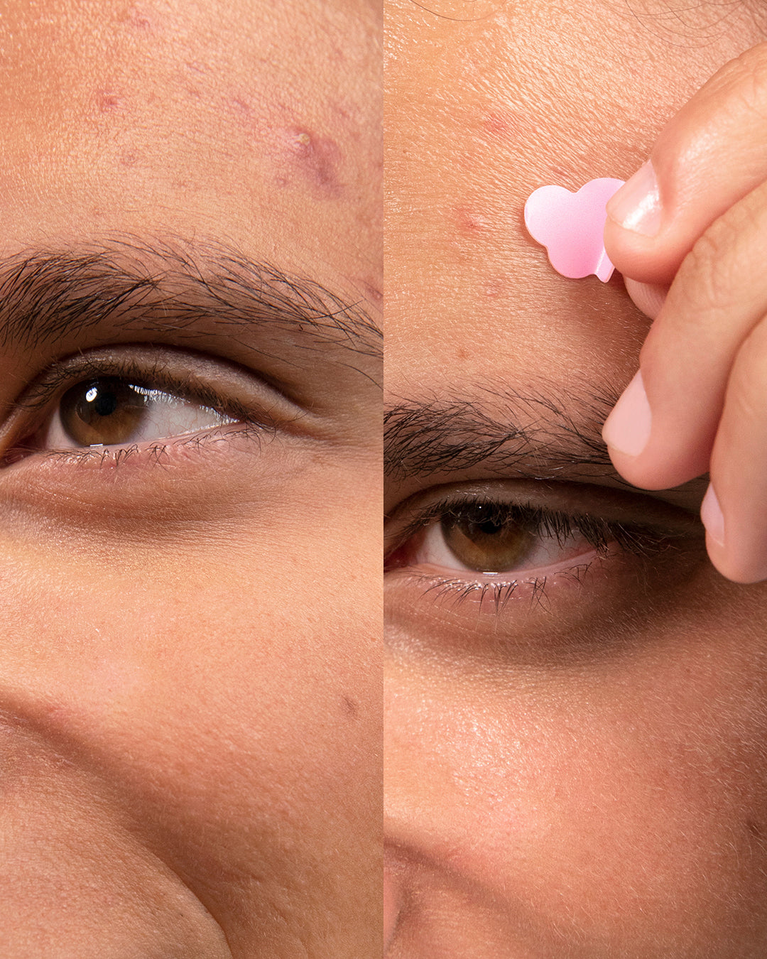 Blemish Patches